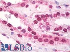 HSF1 Antibody - Anti-HSF1 antibody IHC of human kidney. Immunohistochemistry of formalin-fixed, paraffin-embedded tissue after heat-induced antigen retrieval. Antibody dilution 10 ug/ml.  This image was taken for the unconjugated form of this product. Other forms have not been tested.