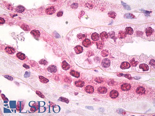 HSF1 Antibody - Anti-HSF1 antibody IHC of human kidney. Immunohistochemistry of formalin-fixed, paraffin-embedded tissue after heat-induced antigen retrieval. Antibody dilution 10 ug/ml.  This image was taken for the unconjugated form of this product. Other forms have not been tested.