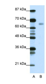 HSF1 Antibody - HSF1 antibody Western blot of Jurkat lysate. This image was taken for the unconjugated form of this product. Other forms have not been tested.