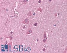 HSF1 Antibody - Anti-HSF1 antibody IHC of human brain, cortex. Immunohistochemistry of formalin-fixed, paraffin-embedded tissue after heat-induced antigen retrieval. Antibody concentration 5 ug/ml.  This image was taken for the unconjugated form of this product. Other forms have not been tested.