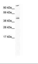 HSF1 Antibody - SP2/0 Cell Lysate.  This image was taken for the unconjugated form of this product. Other forms have not been tested.