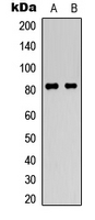 HSF1 Antibody - Western blot analysis of HSF1 (pS307) expression in HepG2 (A); K562 (B) whole cell lysates.