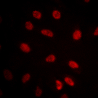 HSF1 Antibody - Immunofluorescent analysis of HSF1 staining in A549 cells. Formalin-fixed cells were permeabilized with 0.1% Triton X-100 in TBS for 5-10 minutes and blocked with 3% BSA-PBS for 30 minutes at room temperature. Cells were probed with the primary antibody in 3% BSA-PBS and incubated overnight at 4 deg C in a humidified chamber. Cells were washed with PBST and incubated with a DyLight 594-conjugated secondary antibody (red) in PBS at room temperature in the dark. DAPI was used to stain the cell nuclei (blue).