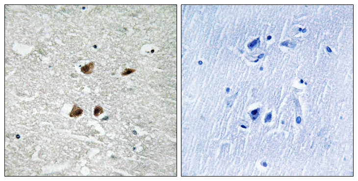 HSF1 Antibody - Immunohistochemistry analysis of paraffin-embedded human brain, using HSF1 (Phospho-Ser121) Antibody. The picture on the right is blocked with the phospho peptide.