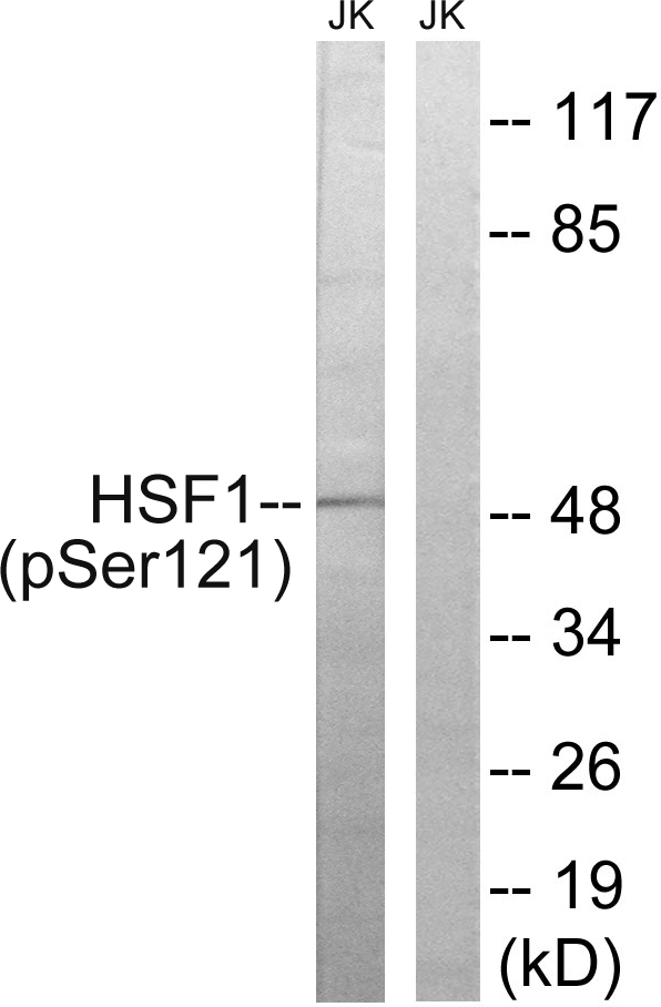 HSF1 Antibody - Western blot analysis of lysates from Jurkat cells treated with TNF 2500U/ML 30', using HSF1 (Phospho-Ser121) Antibody. The lane on the right is blocked with the phospho peptide.