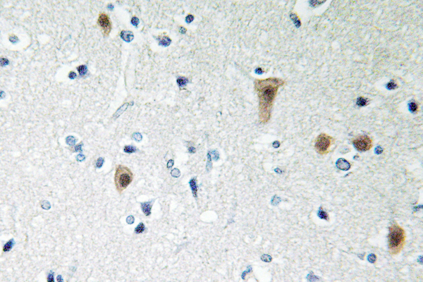 HSF1 Antibody - IHC of p-HSF1 (S303) pAb in paraffin-embedded human brain tissue.