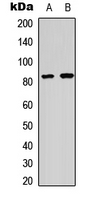 HSF1 Antibody - Western blot analysis of HSF1 (pS303) expression in HeLa (A); COLO205 (B) whole cell lysates.