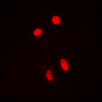 HSF1 Antibody - Immunofluorescent analysis of HSF1 (pS303) staining in HepG2 cells. Formalin-fixed cells were permeabilized with 0.1% Triton X-100 in TBS for 5-10 minutes and blocked with 3% BSA-PBS for 30 minutes at room temperature. Cells were probed with the primary antibody in 3% BSA-PBS and incubated overnight at 4 deg C in a humidified chamber. Cells were washed with PBST and incubated with a DyLight 594-conjugated secondary antibody (red) in PBS at room temperature in the dark. DAPI was used to stain the cell nuclei (blue).
