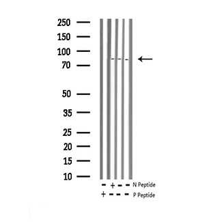 HSF1 Antibody - Western blot analysis of Phospho-HSF1 (Ser303) expression in various lysates