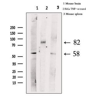 HSF1 Antibody - Western blot analysis of extracts of various samples using Phospho-HSF1 (Ser303) antibody.; lane 1:mouse brain; lane2:HeLa TNF-a treated; lane3:mouse spleen
