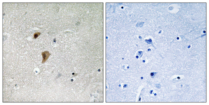 HSF1 Antibody - Immunohistochemistry analysis of paraffin-embedded human brain, using HSF1 (Phospho-Thr142) Antibody. The picture on the right is blocked with the phospho peptide.