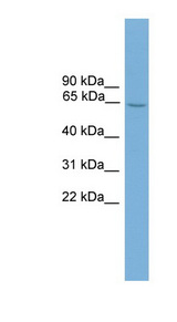 HSF2 Antibody - HSF2 antibody Western blot of Mouse Uterus lysate. This image was taken for the unconjugated form of this product. Other forms have not been tested.