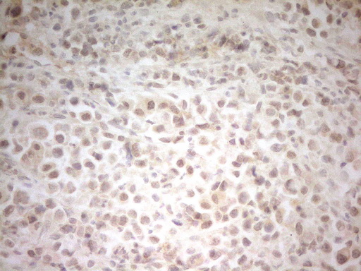 HSF2 Antibody - Immunohistochemical staining of paraffin-embedded Human bladder tissue within the normal limits using anti-HSF2 mouse monoclonal antibody. (Heat-induced epitope retrieval by 1 mM EDTA in 10mM Tris, pH8.5, 120C for 3min,