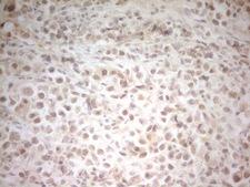 HSF2 Antibody - IHC of paraffin-embedded Human bladder tissue using anti-HSF2 mouse monoclonal antibody. (Heat-induced epitope retrieval by 1 mM EDTA in 10mM Tris, pH8.5, 120°C for 3min).