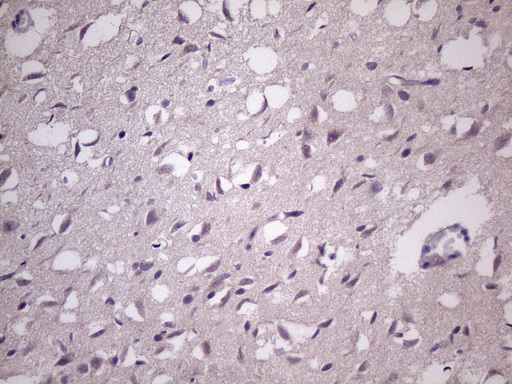 HSF2 Antibody - Immunohistochemical staining of paraffin-embedded Human adult brain tissue using anti-HSF2 mouse monoclonal antibody. (Heat-induced epitope retrieval by 1 mM EDTA in 10mM Tris, pH8.5, 120C for 3min. (1:150)