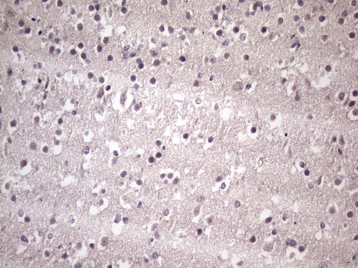 HSF2 Antibody - Immunohistochemical staining of paraffin-embedded Human embryonic brain cortex tissue using anti-HSF2 mouse monoclonal antibody. (Heat-induced epitope retrieval by 1 mM EDTA in 10mM Tris, pH8.5, 120C for 3min. (1:150)