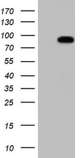 HSF2 Antibody - HEK293T cells were transfected with the pCMV6-ENTRY control (Left lane) or pCMV6-ENTRY HSF2 (Right lane) cDNA for 48 hrs and lysed. Equivalent amounts of cell lysates (5 ug per lane) were separated by SDS-PAGE and immunoblotted with anti-HSF2 (1:2000).