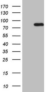 HSF2 Antibody - HEK293T cells were transfected with the pCMV6-ENTRY control (Left lane) or pCMV6-ENTRY HSF2 (Right lane) cDNA for 48 hrs and lysed. Equivalent amounts of cell lysates (5 ug per lane) were separated by SDS-PAGE and immunoblotted with anti-HSF2.