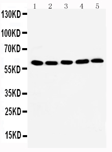 HSF2 Antibody - WB of HSF2 antibody. All lanes: Anti-HSF2 at 0.5ug/ml. Lane 1: Rat Kidney Tissue Lysate at 40ug. Lane 2: Rat Spleen Tissue Lysate at 40ug. Lane 3: 293T Whole Cell Lysate at 40ug. Lane 4: MCF-7 Whole Cell Lysate at 40ug. Lane 5: JURKAT Whole Cell Lysate at 40ug . Lane 6: A549 Whole Cell Lysate at 40ug. Lane 7: CEM Whole Cell Lysate at 40ug. Predicted bind size: 60KD. Observed bind size: 60KD.