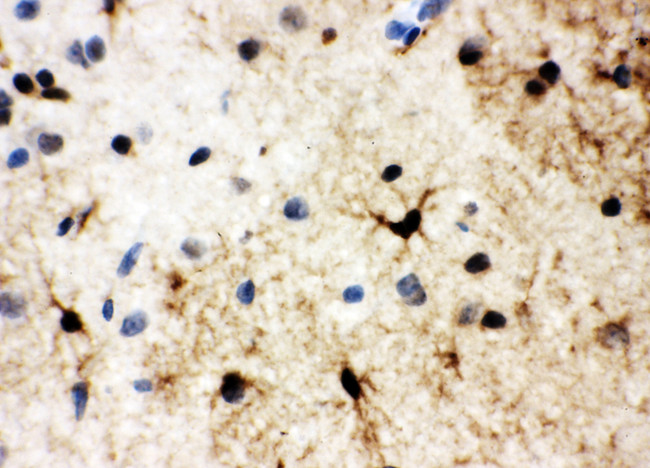 HSF2 Antibody - HSF2 antibody. IHC(P): Rat Brain Tissue.