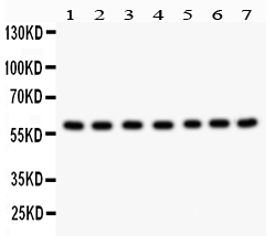 HSF2 Antibody - Anti-HSF2 antibody, Western blotting All lanes: Anti HSF2 at 0.5ug/ml Lane 1: Rat Kidney Tissue Lysate at 50ugLane 2: Rat Spleen Tissue Lysate at 50ugLane 3: 293T Whole Cell Lysate at 40ugLane 4: MCF-7 Whole Cell Lysate at 40ugLane 5: JURKAT Whole Cell Lysate at 40ugLane 6: A549Whole Cell Lysate at 40ugLane 7: CEM Whole Cell Lysate at 40ugPredicted bind size: 60KD Observed bind size: 60KD