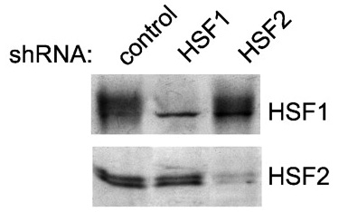 HSF2 Antibody - Western blot analysis (K562 cells) transiently transfected with control, HSF1 or HSF2 shRNA constructs using HSF1, HSF2 (3E2) antibodies.