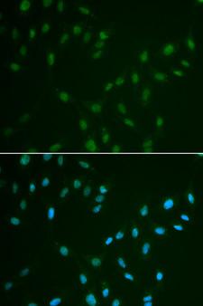 HSF2 Antibody - Immunofluorescence analysis of A549 cells.
