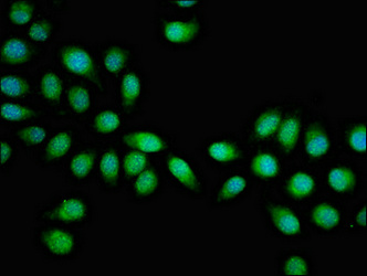 HSF2 Antibody - Immunofluorescent analysis of A549 cells at a dilution of 1:100 and Alexa Fluor 488-congugated AffiniPure Goat Anti-Rabbit IgG(H+L)