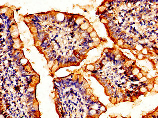 HSF2 Antibody - Immunohistochemistry image of paraffin-embedded human small intestine tissue at a dilution of 1:100
