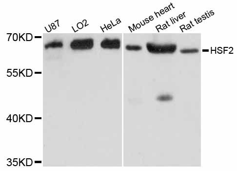 HSF2 Antibody - Western blot analysis of extracts of various cell lines, using HSF2 antibody at 1:3000 dilution. The secondary antibody used was an HRP Goat Anti-Rabbit IgG (H+L) at 1:10000 dilution. Lysates were loaded 25ug per lane and 3% nonfat dry milk in TBST was used for blocking. An ECL Kit was used for detection and the exposure time was 3s.