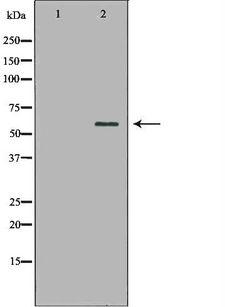 HSF2 Antibody - Western blot analysis of extracts of HeLa cells using HSF2 antibody. The lane on the left is treated with the antigen-specific peptide.