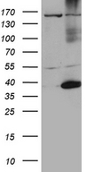 HSF2BP Antibody - HEK293T cells were transfected with the pCMV6-ENTRY control. (Left lane) or pCMV6-ENTRY HSF2BP. (Right lane) cDNA for 48 hrs and lysed. Equivalent amounts of cell lysates. (5 ug per lane) were separated by SDS-PAGE and immunoblotted with anti-HSF2BP. (1:500)