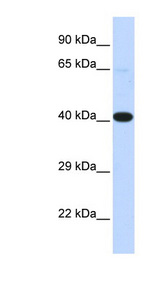 HSF2BP Antibody - HSF2BP antibody Western blot of Fetal Lung lysate. This image was taken for the unconjugated form of this product. Other forms have not been tested.