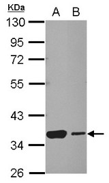 HSF2BP Antibody - Sample (30 ug of whole cell lysate) A: NT2D1 B: SK-N-SH 10% SDS PAGE HSF2BP antibody diluted at 1:1000
