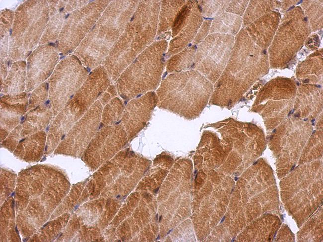 HSF2BP Antibody - IHC of paraffin-embedded Muscle, using HSF2BP antibody at 1:500 dilution.