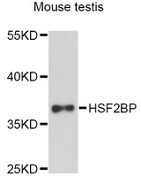 HSF2BP Antibody - Western blot analysis of extracts of mouse testis, using HSF2BP antibody at 1:3000 dilution. The secondary antibody used was an HRP Goat Anti-Rabbit IgG (H+L) at 1:10000 dilution. Lysates were loaded 25ug per lane and 3% nonfat dry milk in TBST was used for blocking. An ECL Kit was used for detection and the exposure time was 90s.