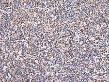HSF2BP Antibody - Immunohistochemistry of paraffin-embedded Human tonsil tissue  using HSF2BP Polyclonal Antibody at dilution of 1:30(×200)