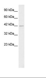 HSF2BP Antibody - Jurkat Cell Lysate.  This image was taken for the unconjugated form of this product. Other forms have not been tested.