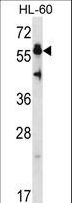 HSF4 Antibody - HSF4 Antibody western blot of HL-60 cell line lysates (35 ug/lane). The HSF4 antibody detected the HSF4 protein (arrow).