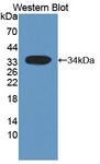 HSF4 Antibody - Western blot of HSF4 antibody.