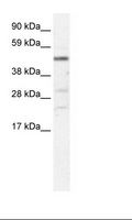 HSFY1 Antibody - Fetal Liver Lysate.  This image was taken for the unconjugated form of this product. Other forms have not been tested.