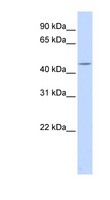 HSFY1 Antibody - HSFY1 antibody Western blot of Fetal Lung lysate. This image was taken for the unconjugated form of this product. Other forms have not been tested.