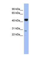 HSFY1 Antibody - HSFY1 antibody Western blot of COLO205 cell lysate. This image was taken for the unconjugated form of this product. Other forms have not been tested.