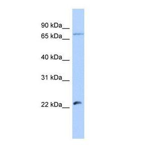 HSFY2 Antibody - Western blot of Human Jurkat. HSFY2 antibody dilution 1.0 ug/ml.  This image was taken for the unconjugated form of this product. Other forms have not been tested.