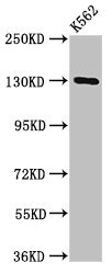 HSorCS / SORCS1 Antibody - Positive Western Blot detected in K562 whole cell lysate. All lanes: SORCS1 antibody at 3 µg/ml Secondary Goat polyclonal to rabbit IgG at 1/50000 dilution. Predicted band size: 130, 134, 132 KDa. Observed band size: 130 KDa