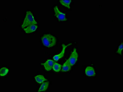 HSorCS / SORCS1 Antibody - Immunofluorescence staining of MCF-7 cells with SORCS1 Antibody at 1:100, counter-stained with DAPI. The cells were fixed in 4% formaldehyde, permeabilized using 0.2% Triton X-100 and blocked in 10% normal Goat Serum. The cells were then incubated with the antibody overnight at 4°C. The secondary antibody was Alexa Fluor 488-congugated AffiniPure Goat Anti-Rabbit IgG(H+L).