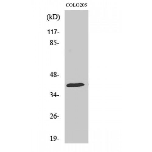 HSP40 Antibody - Western blot of HSP40 antibody