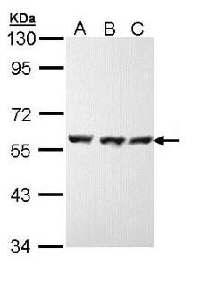 HSP70 / Heat Shock Protein 70 Antibody - Sample (30 ug of whole cell lysate). A: H1299, B: Hela, C: Hep G2 . 7.5% SDS PAGE. HSP70 / Heat Shock Protein 70 antibody diluted at 1:20000.