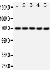 HSP70 / Heat Shock Protein 70 Antibody - Anti-Hsp70 antibody, Western blotting All lanes: Anti Hsp70 at 0.5ug/ml Lane 1: 293T Whole Cell Lysate at 40ug Lane 2: HELA Whole Cell Lysate at 40ug Lane 3: A549 Whole Cell Lysate at 40ug Lane 4: A431 Whole Cell Lysate at 40ug Lane 5: PANC Whole Cell Lysate at 40ug Predicted bind size: 70KD Observed bind size: 70KD