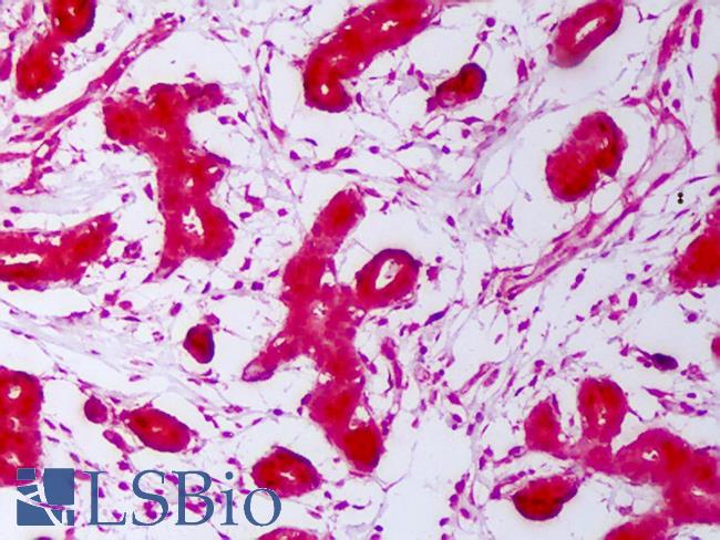 HSP70 / Heat Shock Protein 70 Antibody - Anti-HSP70 / Heat Shock Protein 70 antibody IHC of human breast. Immunohistochemistry of formalin-fixed, paraffin-embedded tissue after heat-induced antigen retrieval. Antibody concentration 2.5 ug/ml.  This image was taken for the unconjugated form of this product. Other forms have not been tested.